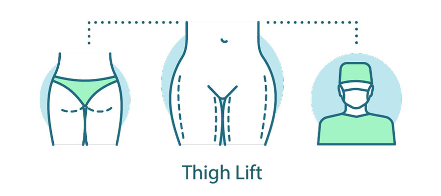 Medial Thigh Lift: The Fundamentals