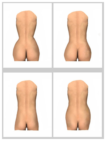 buttock shapes