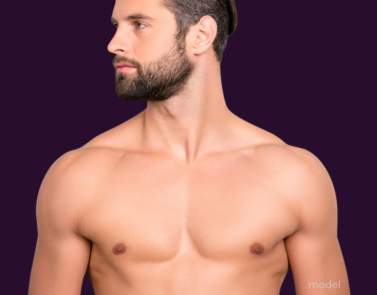 stock photo model for gynecomastia